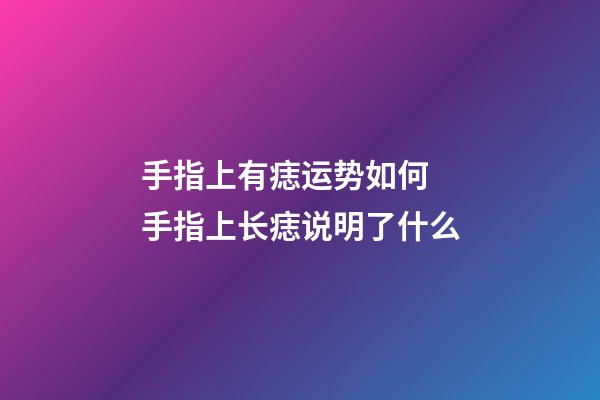 手指上有痣运势如何 手指上长痣说明了什么